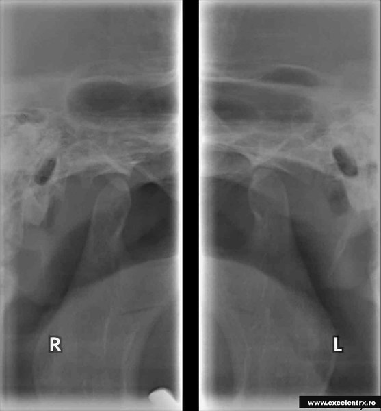 Excelent Rx - Centrul de Radiologie Stomatologica Digitala