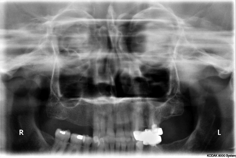 Excelent Rx - Centrul de Radiologie Stomatologica Digitala