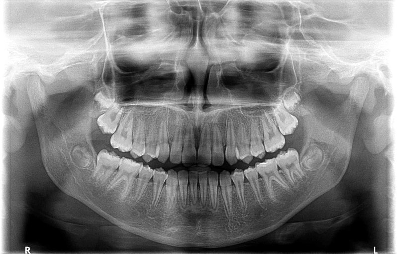 Excelent Rx - Centrul de Radiologie Stomatologica Digitala