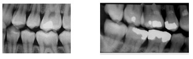 Excelent Rx - Centrul de Radiologie Stomatologica Digitala