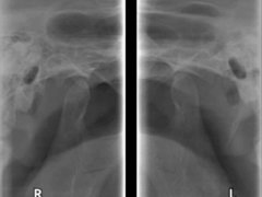 Excelent Rx - Centrul de Radiologie Stomatologica Digitala