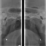 Excelent Rx - Centrul de Radiologie Stomatologica Digitala