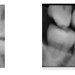 Excelent Rx - Centrul de Radiologie Stomatologica Digitala